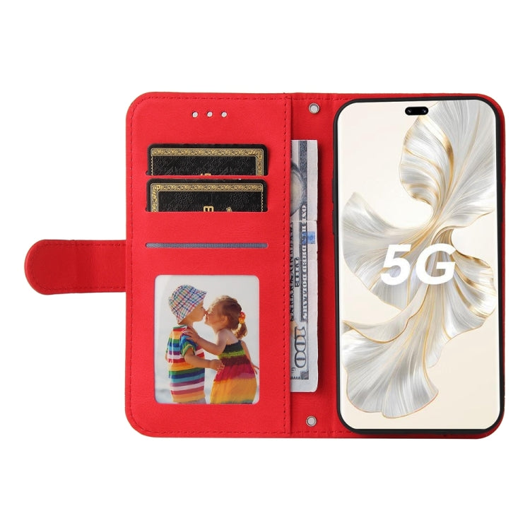 膚感生命樹金屬扣手機皮套, For Honor 100 Pro, For Honor 100, For Honor X50i+, For Honor Play 50 Plus, For Honor X6a, For Honor X50i 5G