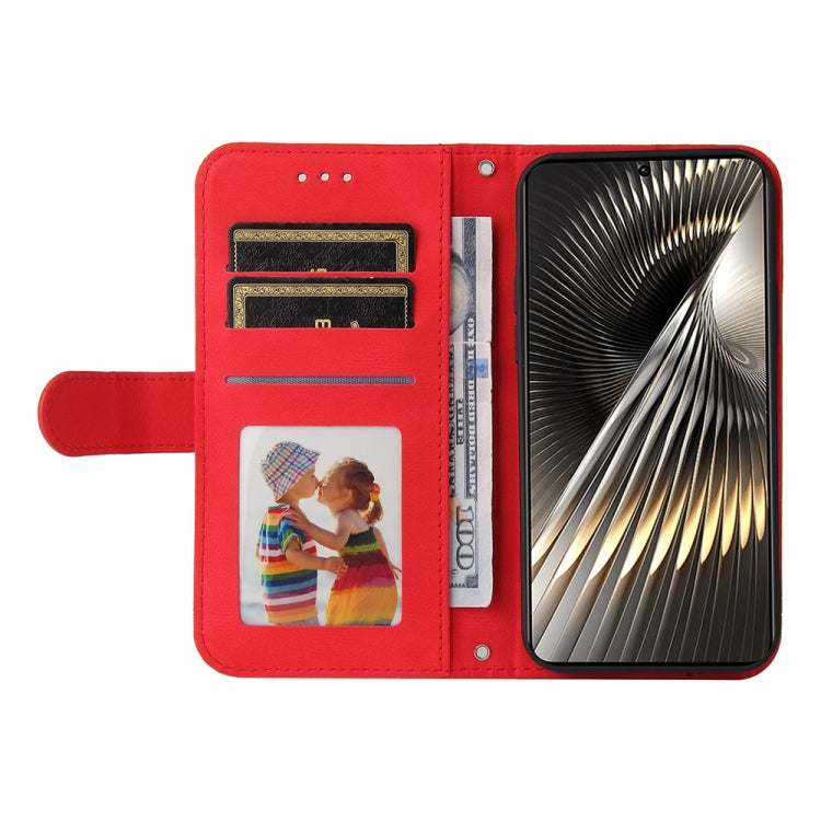 膚感生命樹金屬扣手機皮套, For Xiaomi Poco F6, For Xiaomi Redmi A3, For Xiaomi Redmi Note13 Pro 4G Global/Poco M6 Pro 4G, For Xiaomi Redmi Note13 4G, For Xiaomi Redmi K70E, For Xiaomi 14 Ultra, For Xiaomi 14 Pro, For Xiaomi 14, For Xiaomi Redmi Note13 5G Global