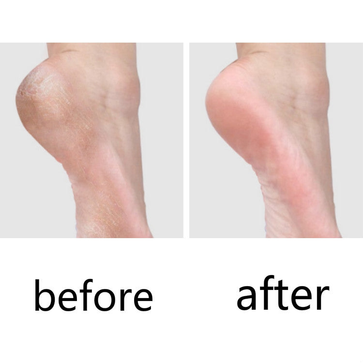 10個賣 修腳刀去死皮老繭刮腳刀