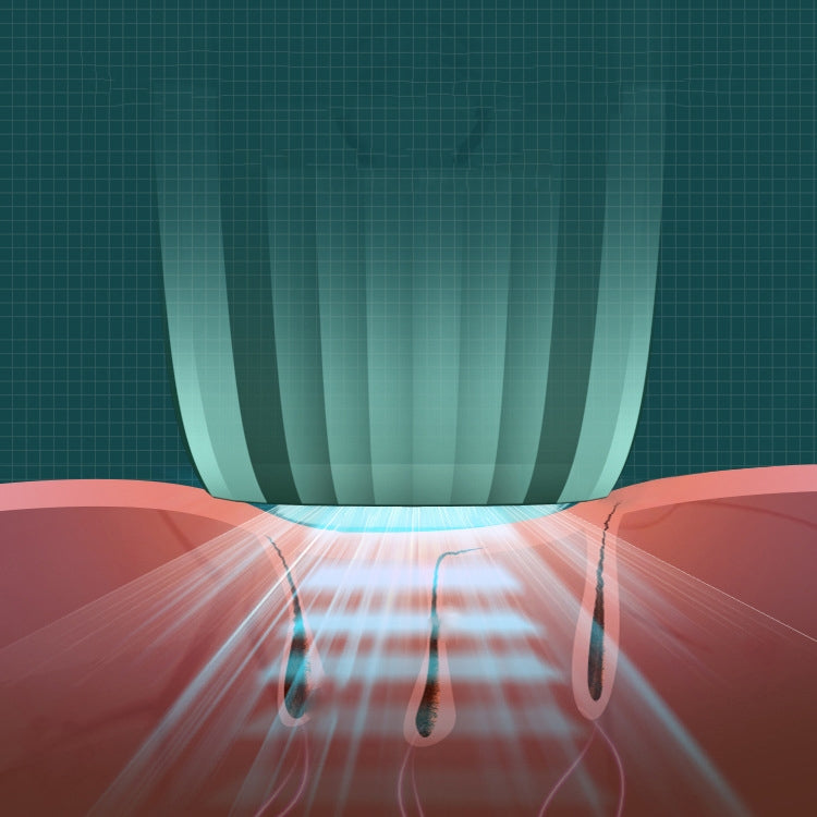 FY-B500 激光脫毛儀器 家用電動IPL脫毛機
