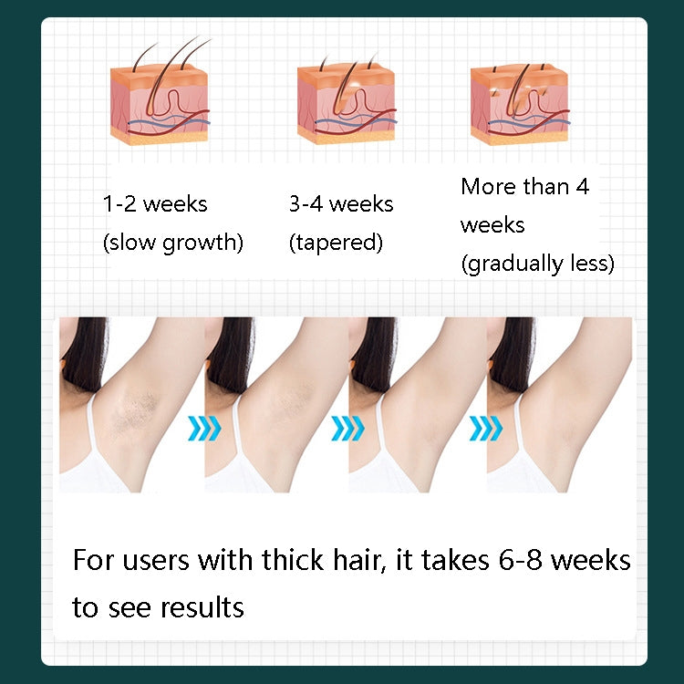 FY-B500 激光脫毛儀器 家用電動IPL脫毛機