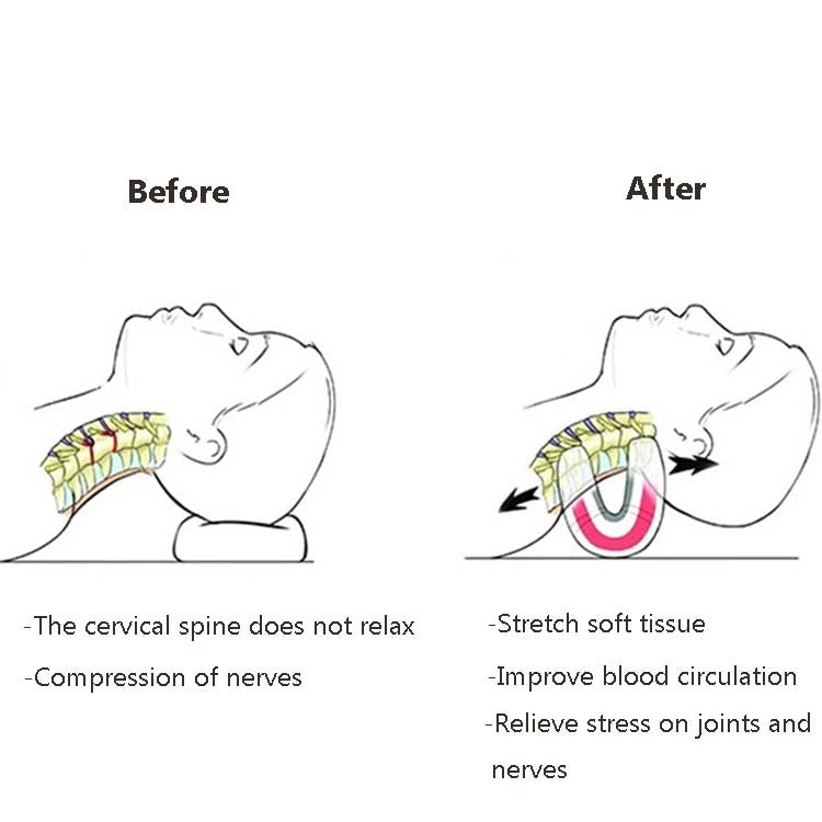 頸椎枕頭拉伸按摩器矯正器便攜護頸枕