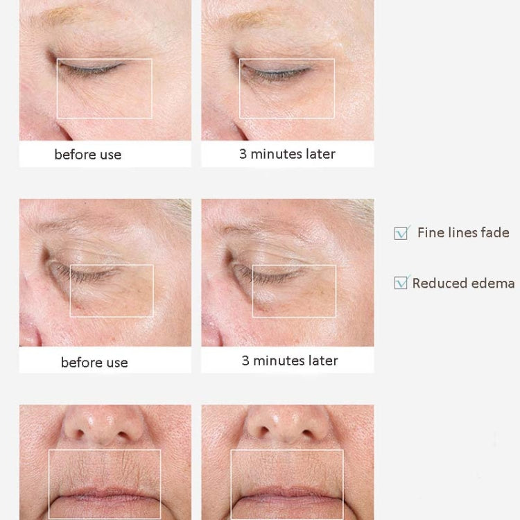 眼部唇部按摩儀器淡化眼袋美眼儀去黑眼圈導入美容儀不含電池款