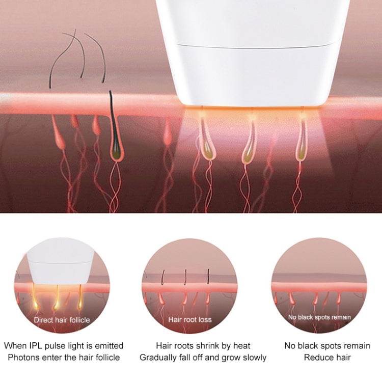 愛滿分 10萬次閃光專業IPL脫毛器 激光脫毛 女士無痛穿線脫毛機