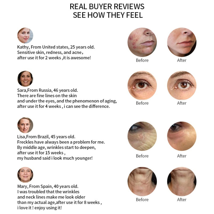 無線電中胚層電穿孔面部美容筆射頻LED光子面部皮膚嫩膚去除皺紋