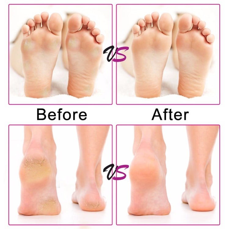 電動修足機 速度可調砂紙圓片去除角質修腳工具 腳部老繭乾燥死皮去除器