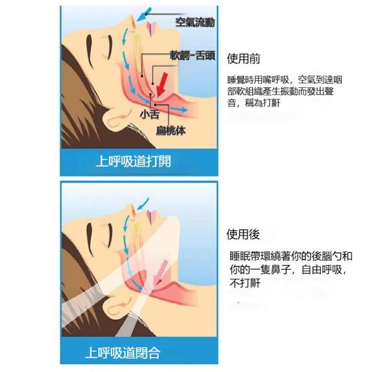 三角止鼾帶男女成人防打鼾下巴托